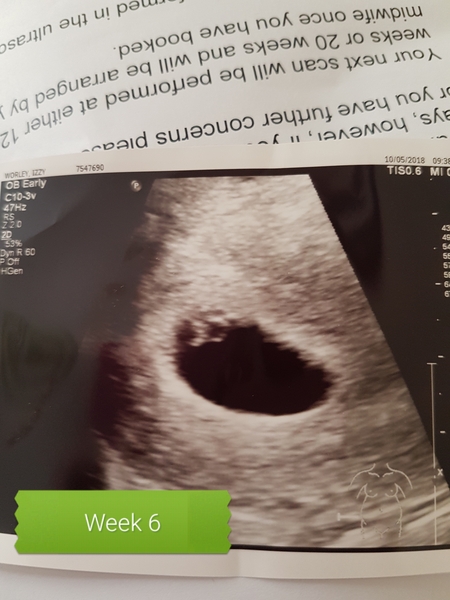 Scan at 5.3 weeks