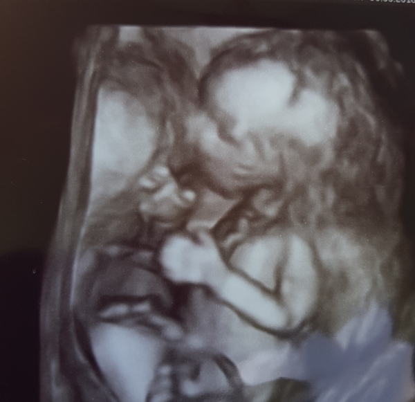 December 2018 Babies - Thread #3