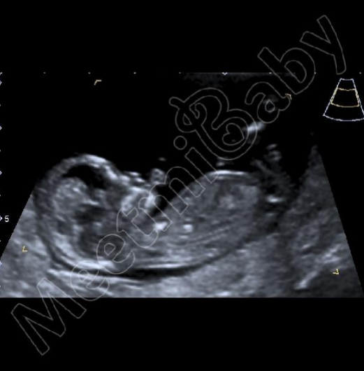 Boy or girl?