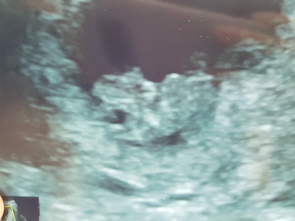 December 2018 Babies - Thread #2