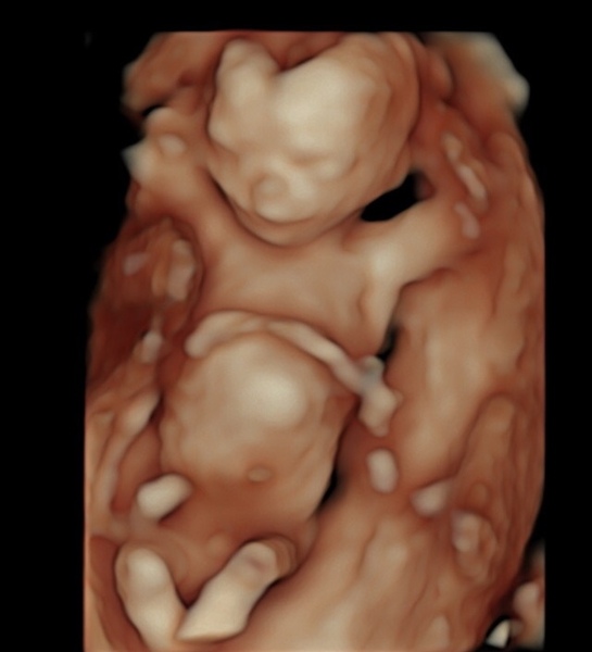 December 2018 Babies - Thread #2