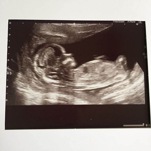 December 2018 Babies - Thread #3