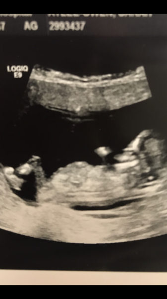 December 2018 Babies - Thread #2