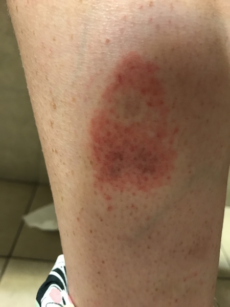 Strange rash- can anyone advise?