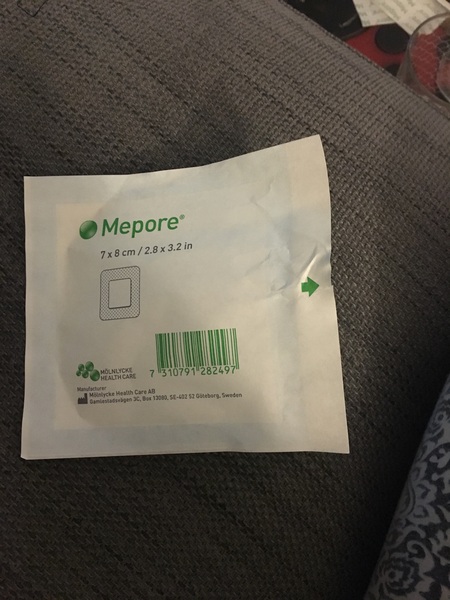 for your delectation - DH's infected sebaceous cyst