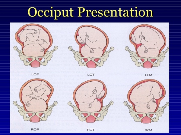 I’m a midwife, ask me anything