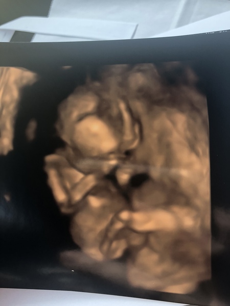 First Pregnancies with Nov/Dec Due dates :)