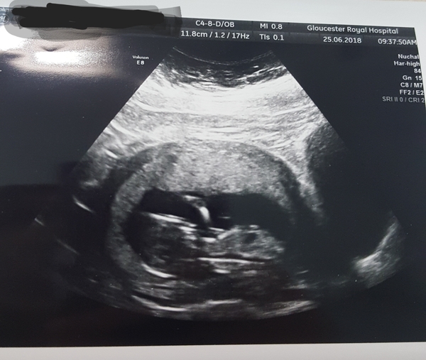 Newbie to the pregnancy board! Due end of December.. anyone else due around the same time?