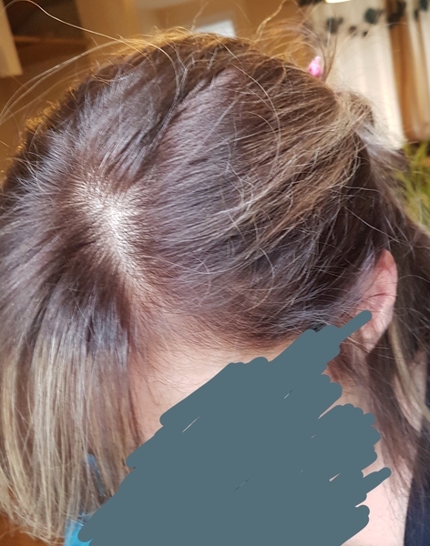 This isn't right is it? What did she actually do to my hair and how do I fix it?