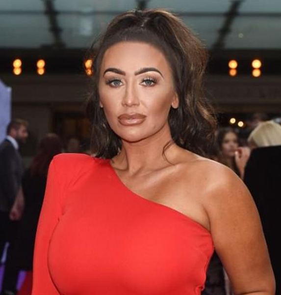 Lauren Goodger needs to quit the lip filler.