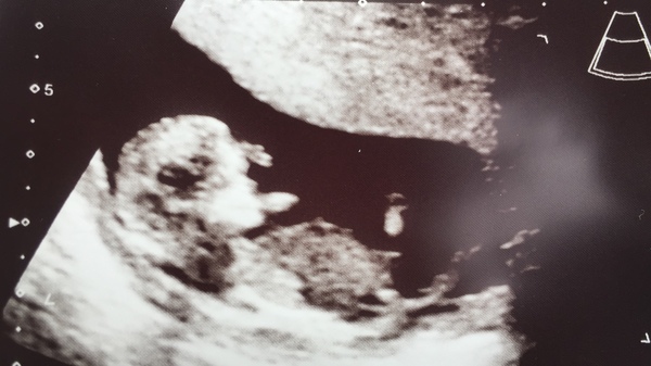 December 2018 Babies - Thread #2