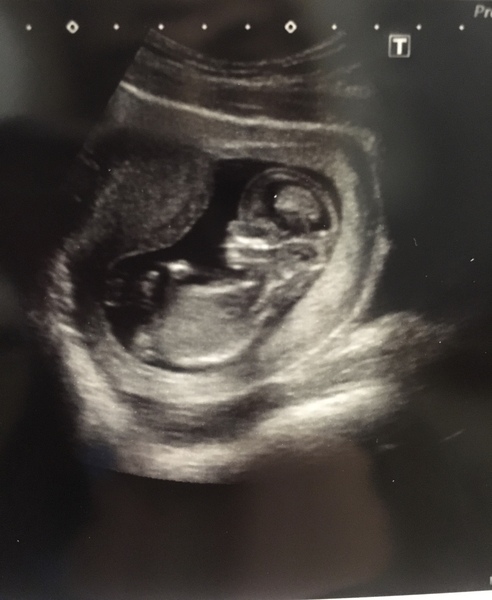 December 2018 Babies - Thread #2