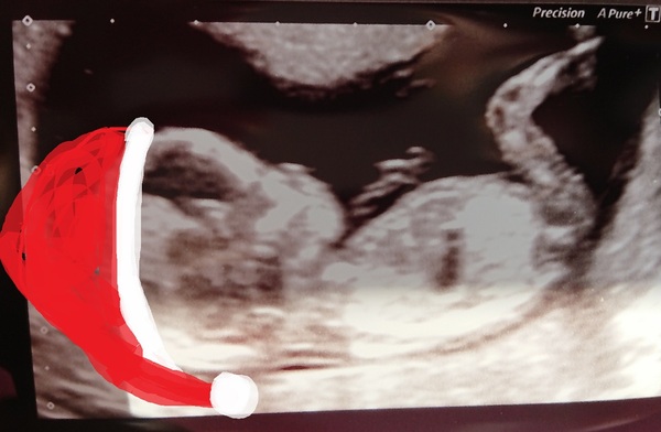 December 2018 Babies - Thread #3