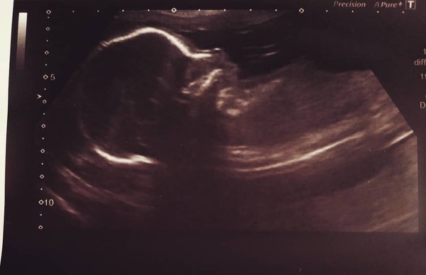 October 2018 baby bus part 3