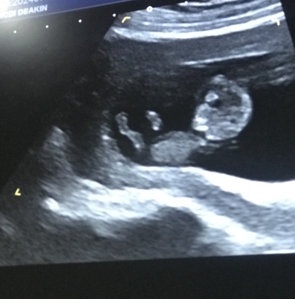 January 2019, thread 2