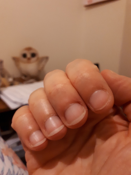 Nails