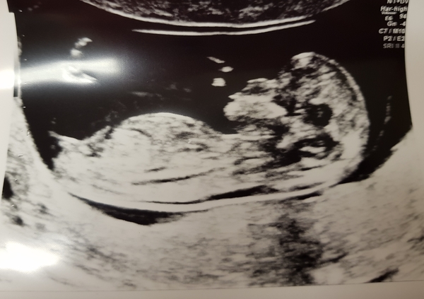 More cake for more babies... BFP after MC