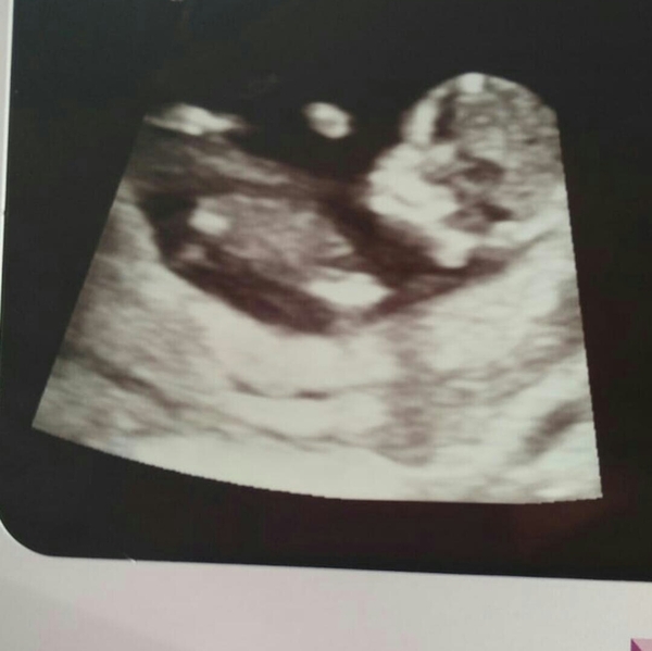 December 2018 Babies - Thread #3