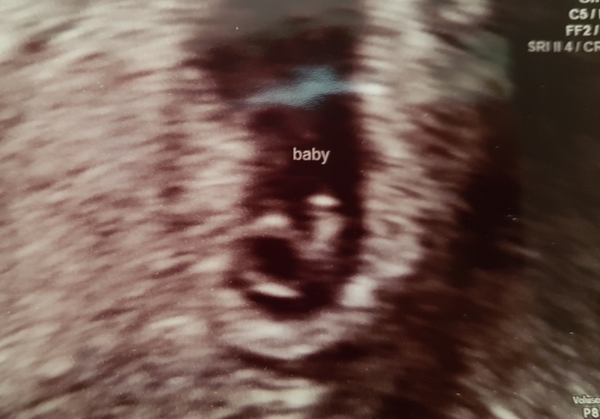 Due February 2019 part 2