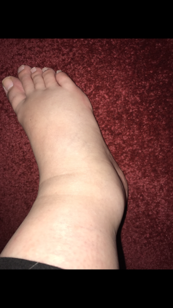 Feet have swollen ALOT