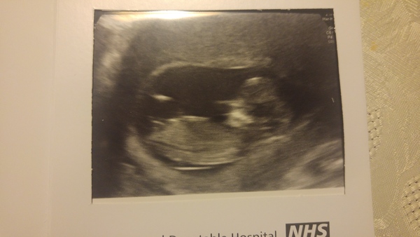 More cake for more babies... BFP after MC