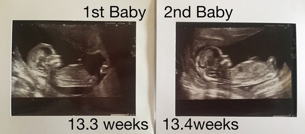 More cake for more babies... BFP after MC