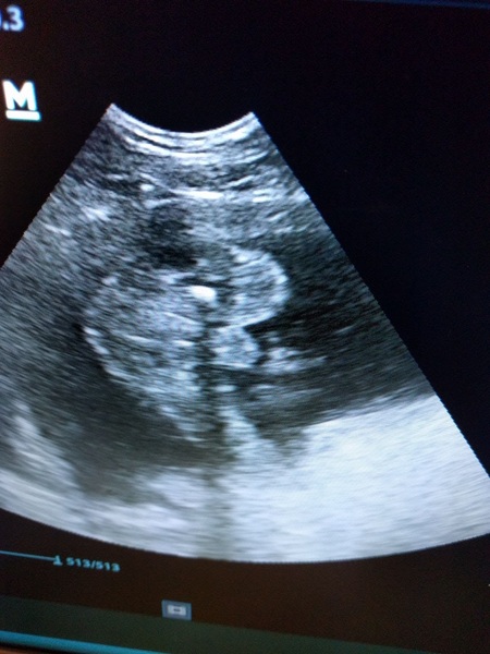 Scan picture inbetween the legs! Boy or girl?