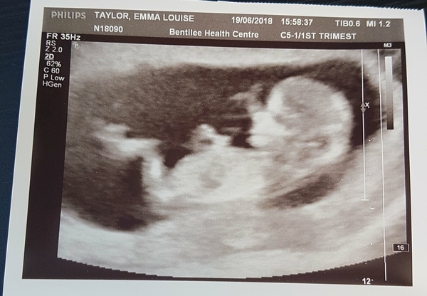Newbie to the pregnancy board! Due end of December.. anyone else due around the same time?