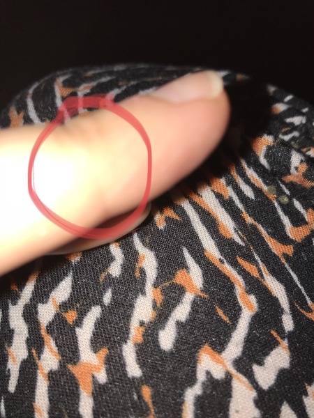 Arthritis? Pic inc.