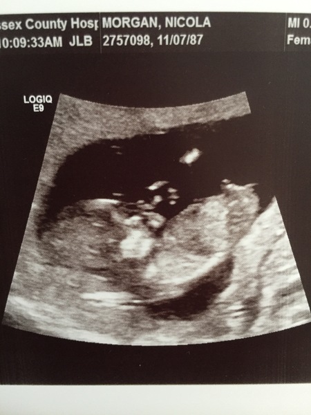 December 2018 Babies - Thread #2