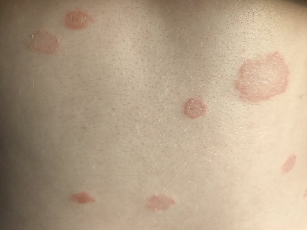 What’s this on my stomach? (with photo)