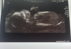 20 week scan tomorrow...eeek!!