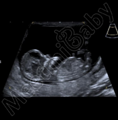 Nub Theory. Boy or Girl?