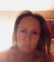 Has anyone had Botox to fix a downturned mouth?
