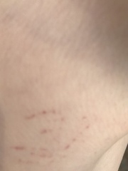 Red ring on DS’ chest