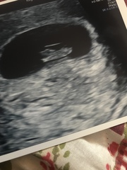 More cake for more babies... BFP after MC