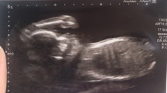 20 week scan tomorrow...eeek!!