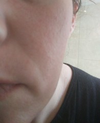 Help my skin is a mess