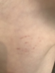 Red ring on DS’ chest