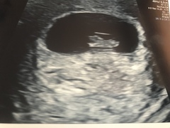 More cake for more babies... BFP after MC