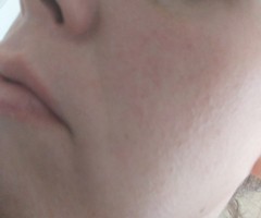 Help my skin is a mess