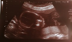 Fresh Start thread for pregnancy after miscarriage or loss