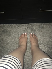 Feet have swollen ALOT