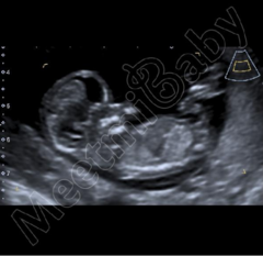 Boy or girl? Any guesses!!!