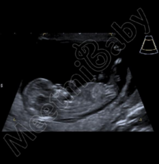 Boy or girl? Any guesses!!!