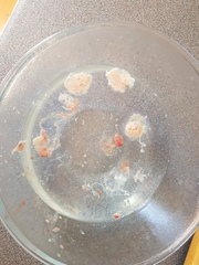 Warning disgusting pic! Sinus drain round 2