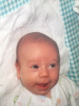 Has anyone regretted putting their baby in a helmet for plagiocephaly?