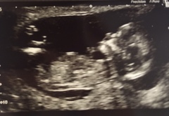 Girl or boy?