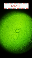 Saliva Microscope - So Excited! Anyone else using?