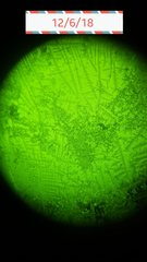 Saliva Microscope - So Excited! Anyone else using?
